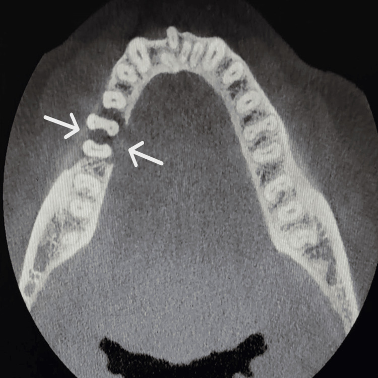 Figure 5