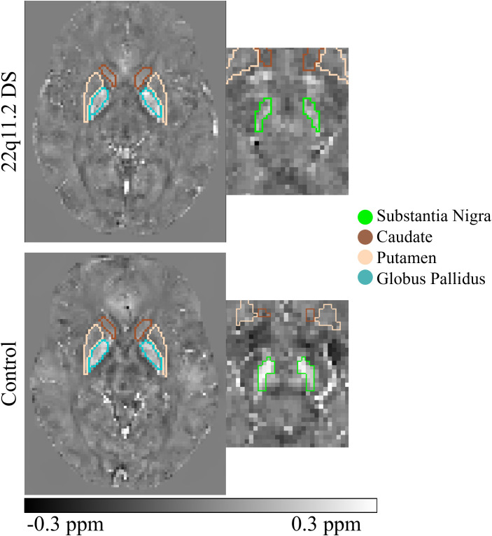 Figure 2