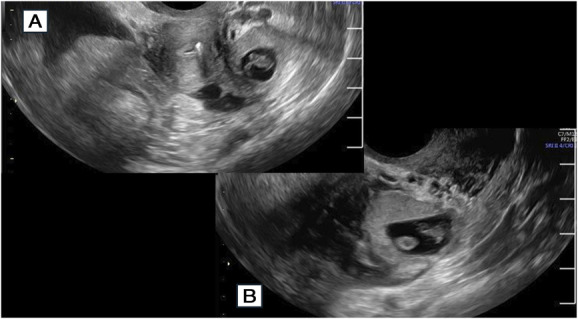 Fig. 2