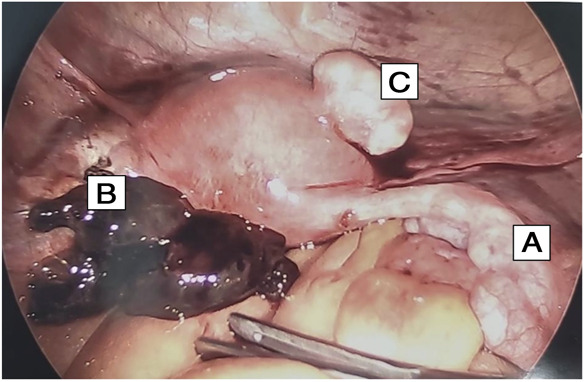 Fig. 3