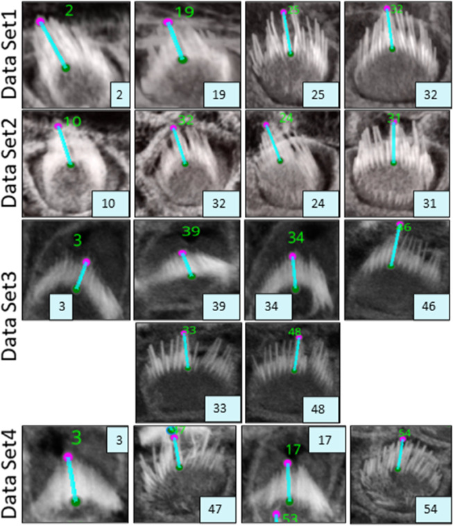 Fig 9