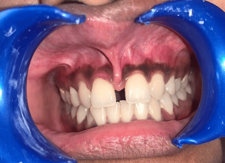 Figure 10