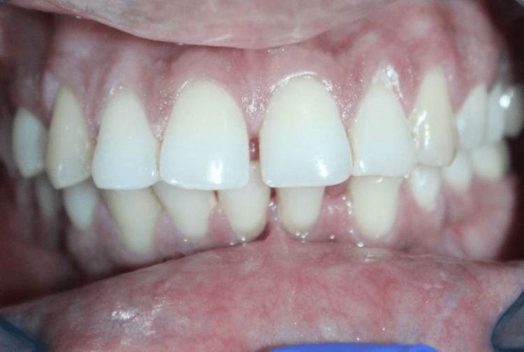 Figure 11
