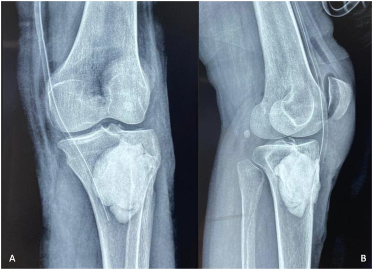 Figure 10