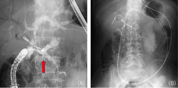 FIGURE 3
