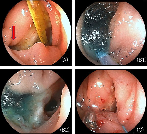 FIGURE 2