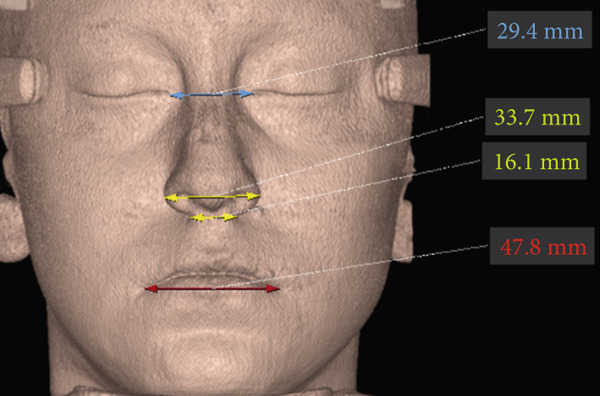 Figure 4