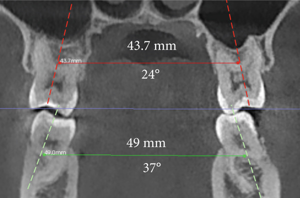 Figure 6