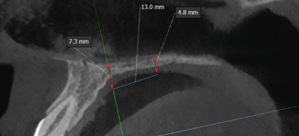 Figure 10