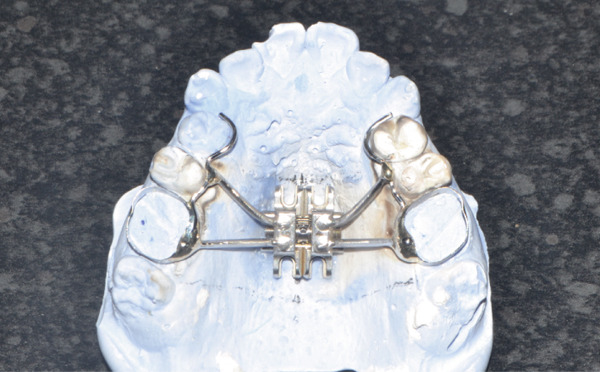 Figure 11