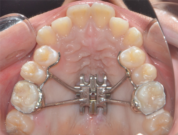 Figure 14