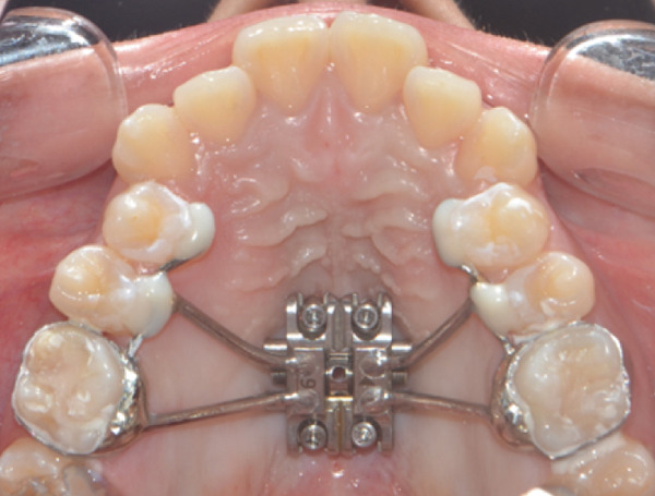 Figure 15
