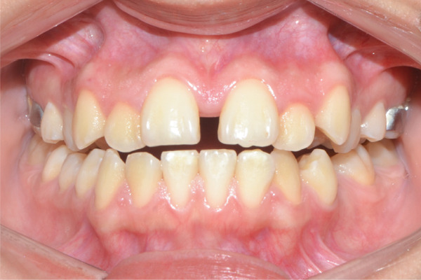 Figure 17