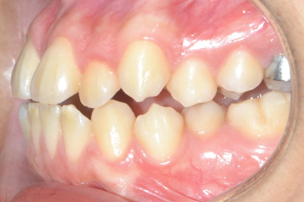 Figure 18