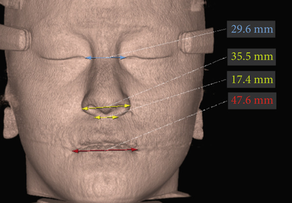 Figure 19