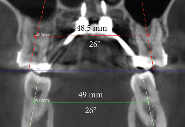 Figure 21