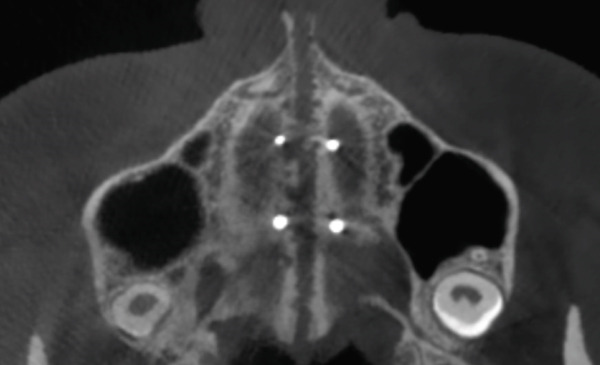 Figure 23