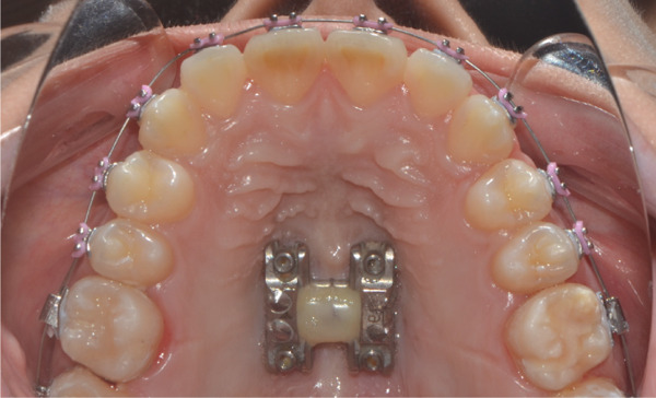 Figure 25