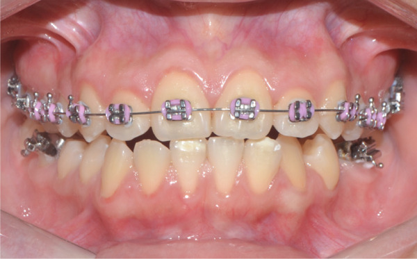 Figure 26