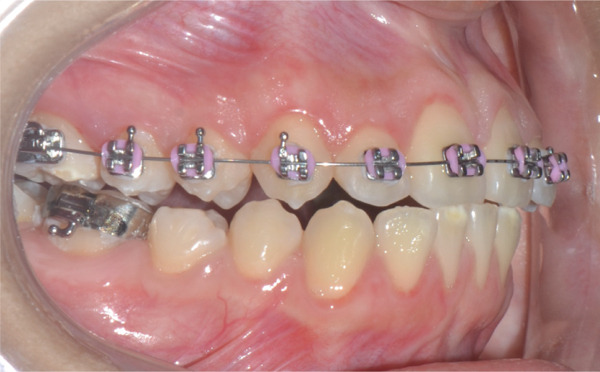 Figure 27