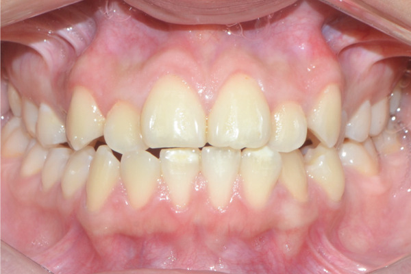 Figure 28