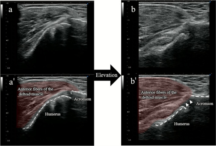 FIGURE 2