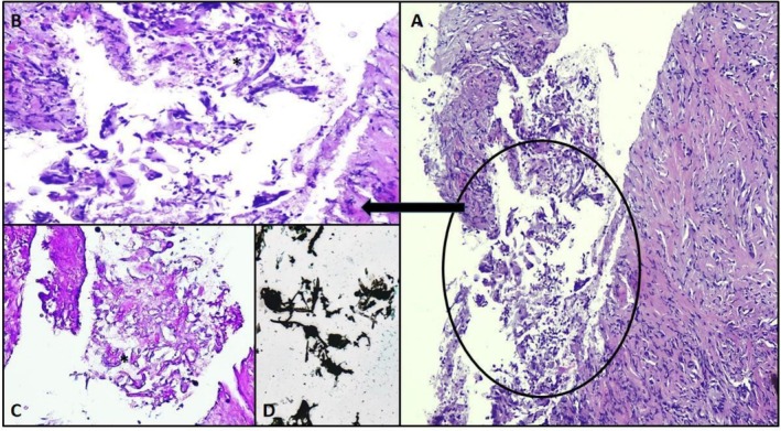 FIGURE 3