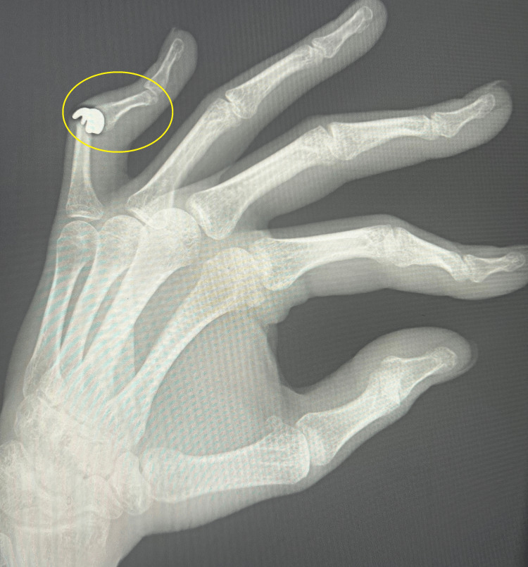Figure 5