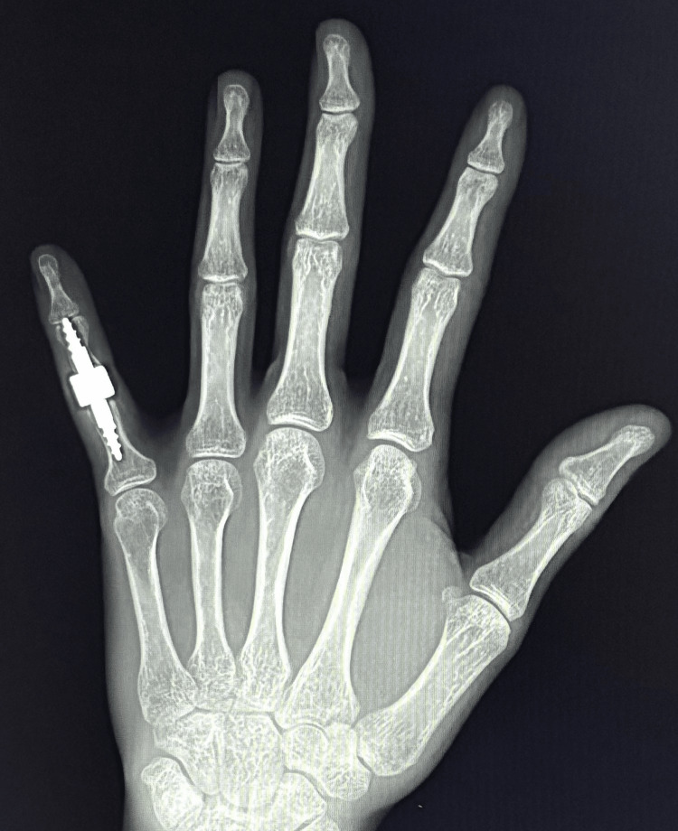 Figure 10