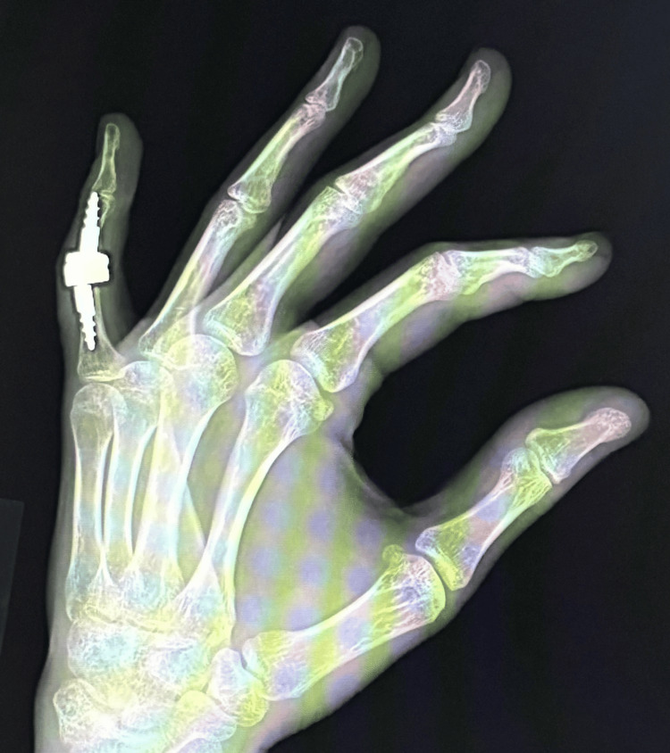 Figure 11