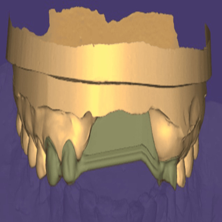 Figure 9