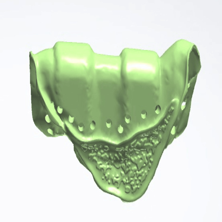 Figure 12