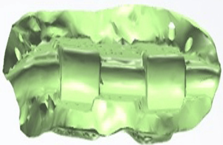 Figure 13