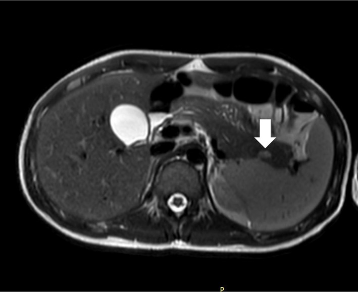 FIGURE 1