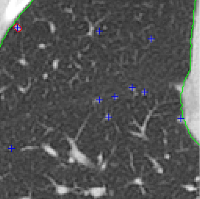 Figure 11