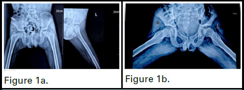 Figure 1a