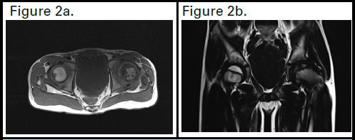 Figure 2a