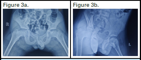 Figure 3a, 3b