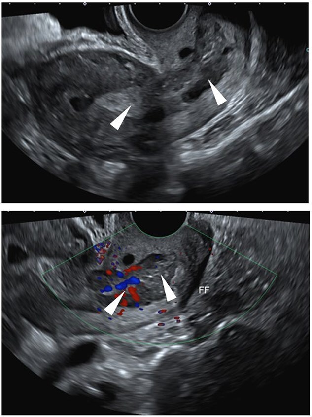 Figure 11