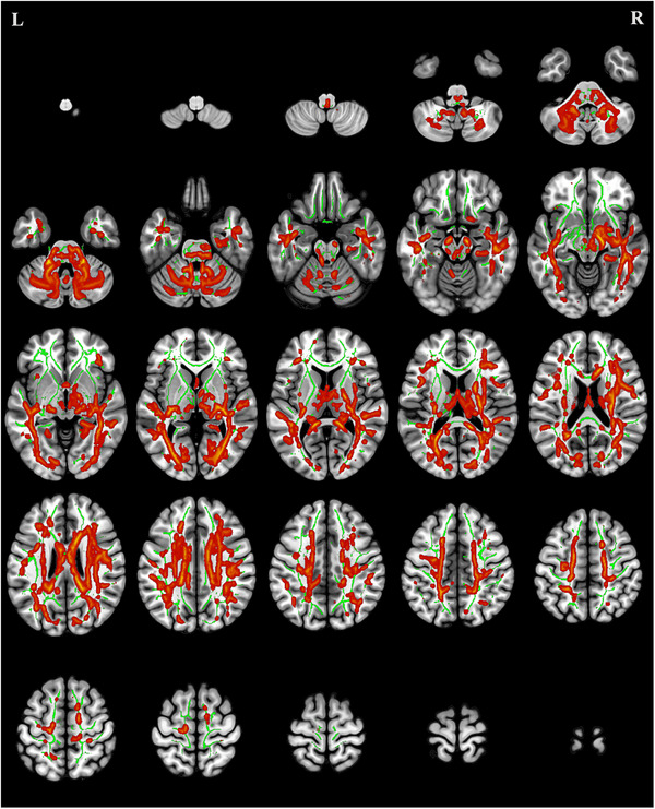 FIGURE 3