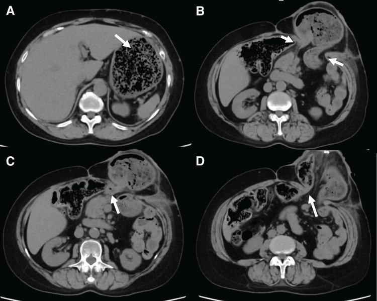 Fig. 2