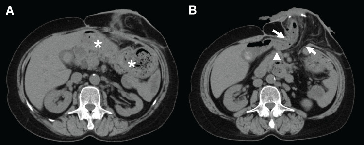 Fig. 6