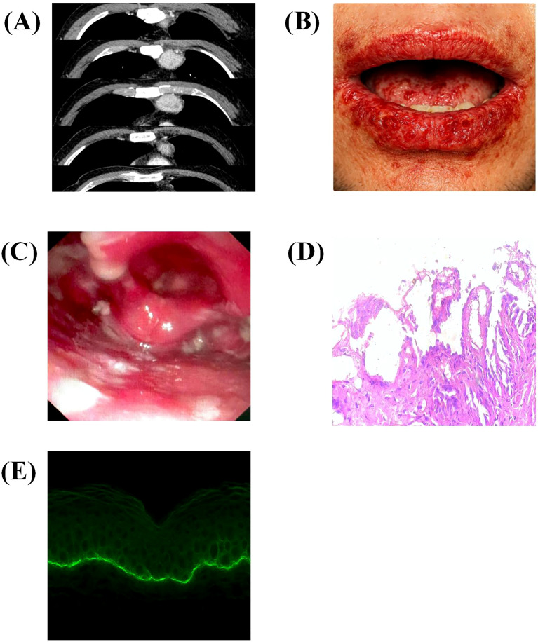 Figure 2