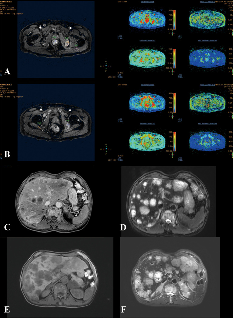 Figure 2