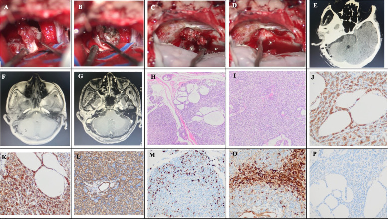 Figure 3