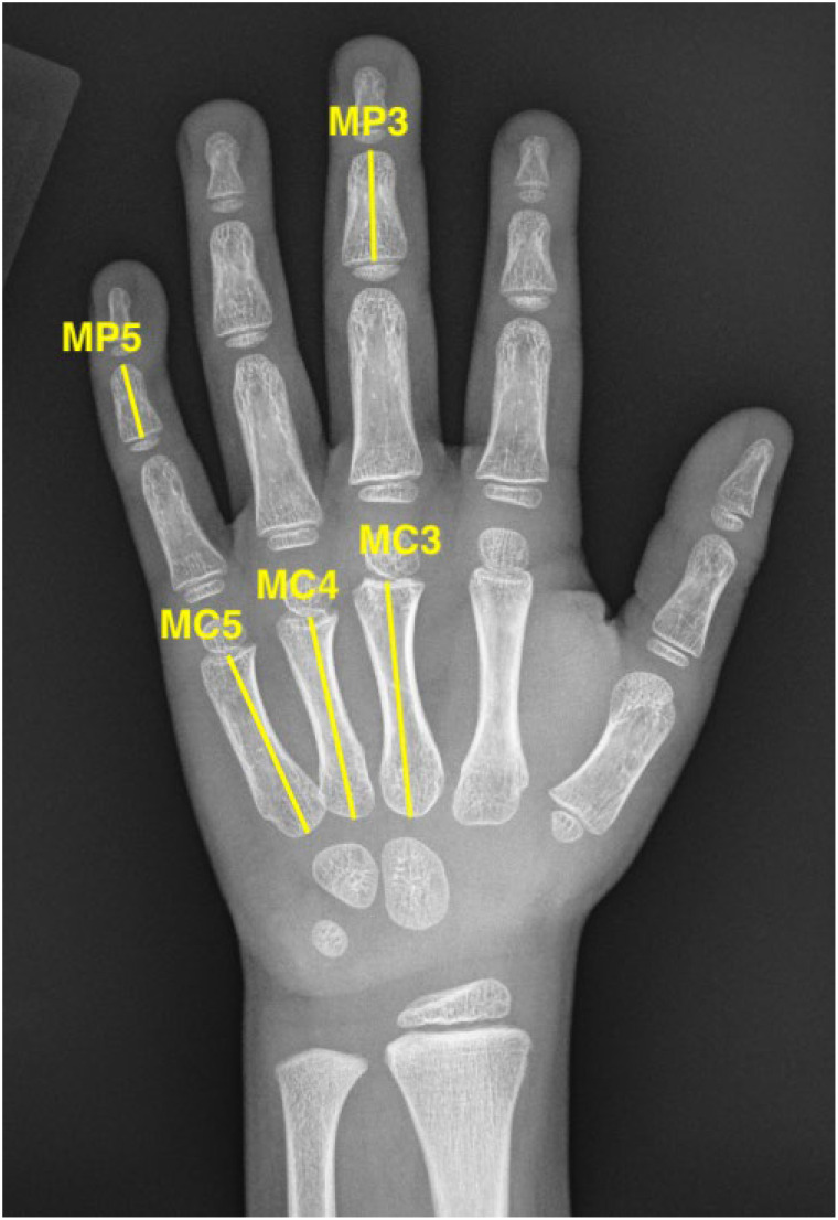 Figure 2