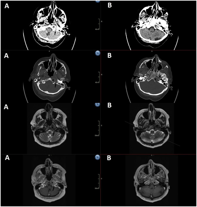 Figure 2
