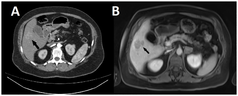 Figure 4