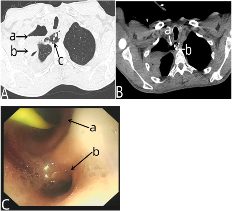 Figure 3