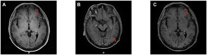 Figure 2